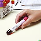 FDA approves first blood test to evaluate concussions in adults